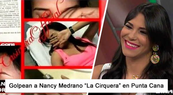 Dos mujeres golpean a Nancy Medrano «La Cirquera» en Punta Cana