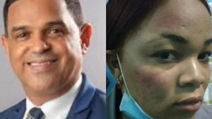 Diputado Sadoki Duarte, en riesgo de expulsión del PRM tras agredir mujer policía