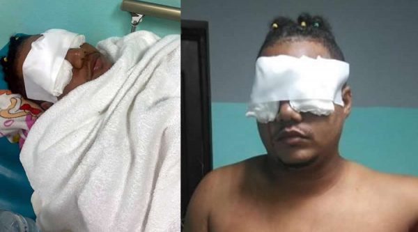 Atacan hijo de locutor y le puyan los ojos con unas tijeras en presunto «asalto»