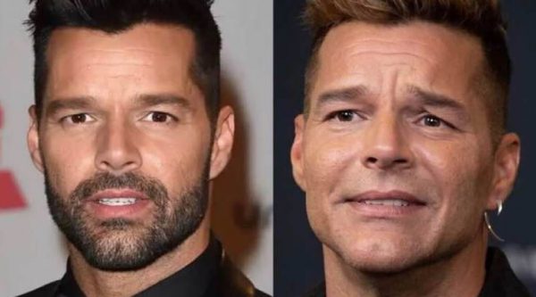 El rostro de Ricky Martin: La verdad detrás de los supuestos arreglos estéticos