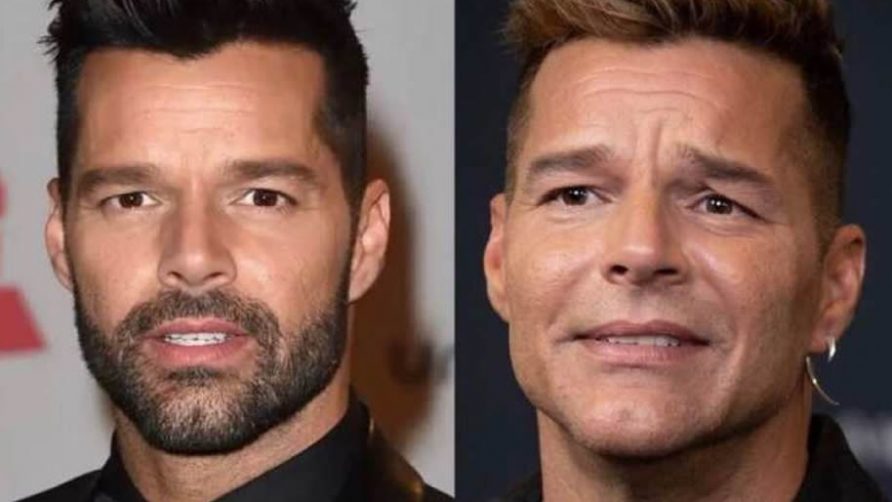 El rostro de Ricky Martin: La verdad detrás de los supuestos arreglos estéticos