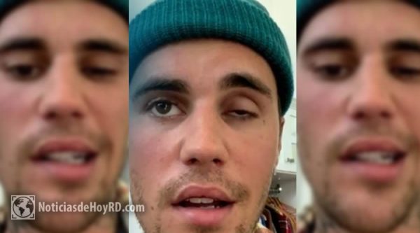 Video: Justin Bieber sufre una parálisis